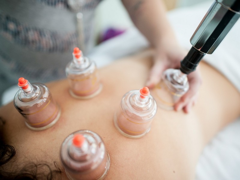 cupping therapy, or buhang (부항), traditional medicine