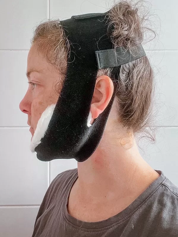 AB Plastic Surgery Clinic, plastic surgery in Seoul, Gangnam, Seoul, Korea; Day 1 post op