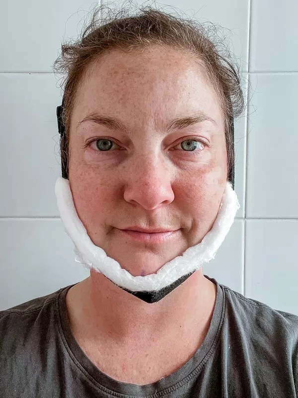 AB Plastic Surgery Clinic, plastic surgery in Seoul, Gangnam, Seoul, Korea; Day 1 post op