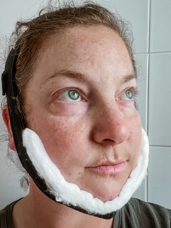 AB Plastic Surgery Clinic, plastic surgery in Seoul, Gangnam, Seoul, Korea; Day 1 post op