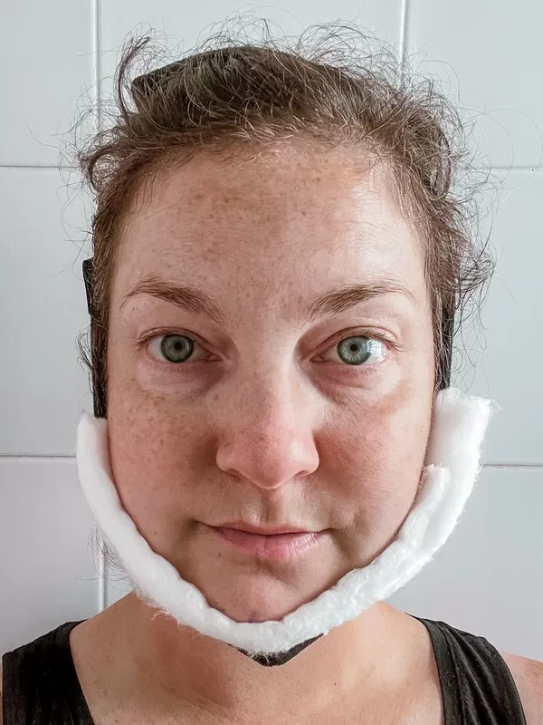 AB Plastic Surgery Clinic, plastic surgery in Seoul, Gangnam, Seoul, Korea; Day 2 post op