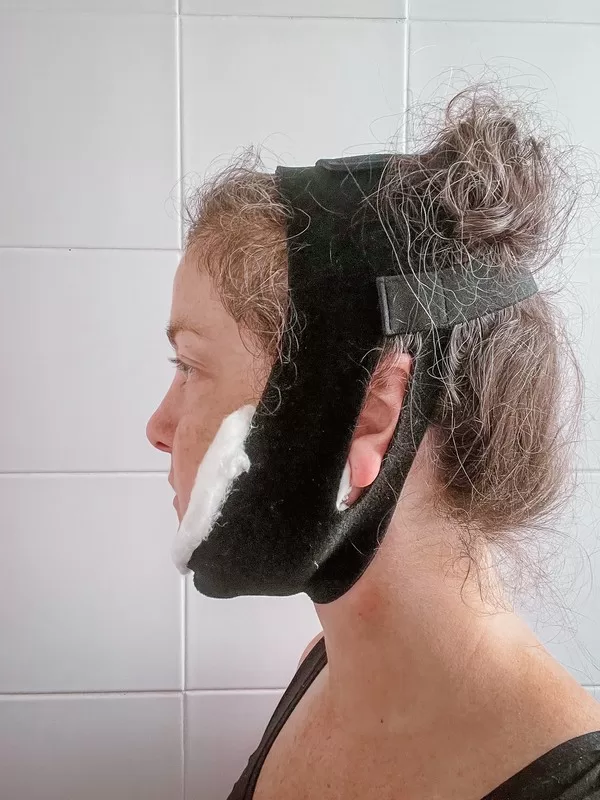 AB Plastic Surgery Clinic, plastic surgery in Seoul, Gangnam, Seoul, Korea; Day 2 post op