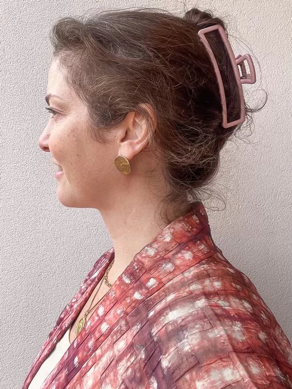 AB Plastic Surgery Clinic, plastic surgery in Seoul, Gangnam, Seoul, Korea; 8 months post op