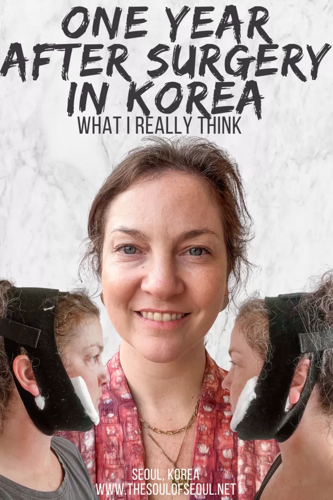 One Year After Cosmetic Surgery in Korea: The Honest Update Nobody Talks About: One year after genioplasty, elasticum, submentoplasty, and Accu 2 Part at AB Plastic Surgery Clinic in Seoul, here's the honest update on results, numbness, and what I'd do differently.