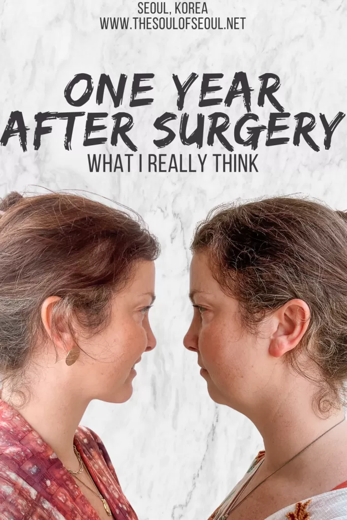 One Year After Cosmetic Surgery in Korea: The Honest Update Nobody Talks About: One year after genioplasty, elasticum, submentoplasty, and Accu 2 Part at AB Plastic Surgery Clinic in Seoul, here's the honest update on results, numbness, and what I'd do differently.